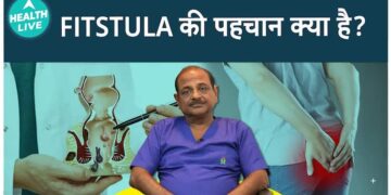 ફિસ્ટુલાની રચનાને સમજવી: તે કેવી રીતે શરૂ થાય છે, કારણો અને તમારે શું જાણવું જોઈએ | આરોગ્ય જીવંત