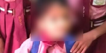 પ્રાયગરાજ સમાચાર: આઘાતજનક! શિક્ષક 3 વર્ષનો થપ્પડ મારતો, છોકરો મરી જાય છે